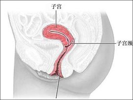 子宫颈原位癌累及腺体