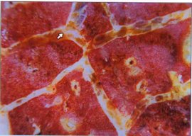 牛传染性胸膜肺炎