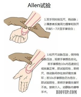 Allen试验