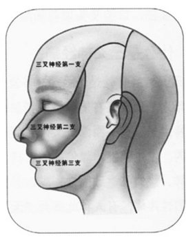 三叉神经痛最新疗法_360百科